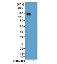 Western blot of nonreduced(-) and reduced(+) mouse IgG2a, using 0.5ug/ml of recombinant Mouse IgG2a 