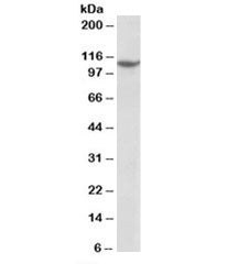 Western blot testing of Jurkat nuclear lysate with PRPF6 antibody at 1ug/ml. Predicted molecular wei