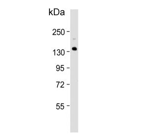 Western blot testing of human fetal liver tissue lysate with XDH antibody. Predicted molecular weigh