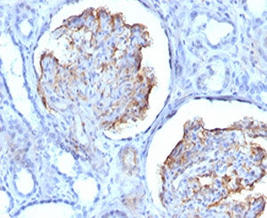 WT1 Antibody / Wilms Tumor 1