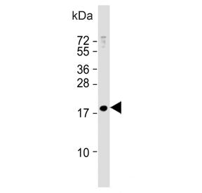 Western blot testing of human MCF7 cell lysate with MBD3L3 antibody. Predicted molecular weight ~23 