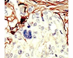LKB1 Antibody (Liver Kinase B1)