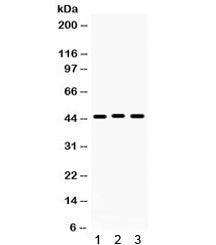 Western blot testing of 1) rat stomach, 2) human HeLa and 3) human PANC lysate with Connexin 45 anti