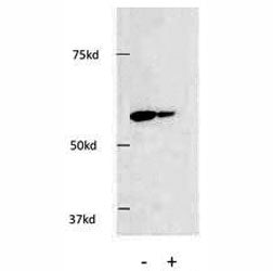 HDAC1 Antibody