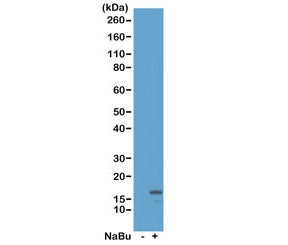 H3K18ac Antibody / Acetyl Histone H3 Lysine 18