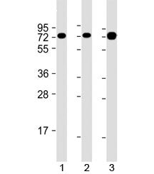 GARS Antibody / Glycine--tRNA ligase