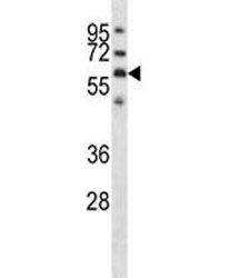 GPC3 Antibody