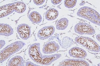 DR1 Antibody / Down-regulator of transcription 1