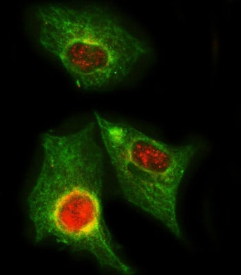 PPP2R5A Antibody