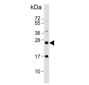 Western blot testing of human HCT-116 cell lysate with RAB8A antibody. Predicted molecular weight ~2