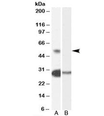 TCFL5 Antibody