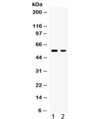 Western blot testing of 1) rat brain and 2) human K562 lysate with SLC2A5 antibody. Expected/observe