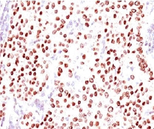 Progesterone Receptor Antibody