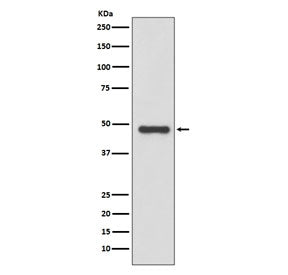 Urokinase Antibody / uPA / PLAU