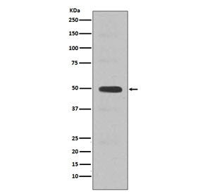 Cyclin E2 Antibody / CCNE2