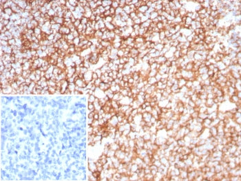 IHC staining of FFPE human tonsil tissue with Clusterin antibody (clone CLU/8865R). Inset: PBS used 