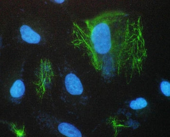 SCNN1A Antibody