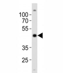 Western blot analysis of lysate from NCCIT cell line using POU5F1 antibody at 1:1000. Predicted mole