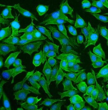 SPTAN1 Antibody / Alpha II Spectrin / Alpha Fodrin / NEAS