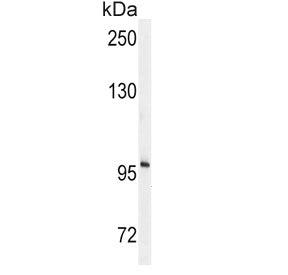 Autotaxin Antibody / ENPP2