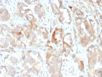 IHC staining of FFPE human prostate with Cytokeratin 6B antibody (clone KRT6B/2116). HIER: boil tiss