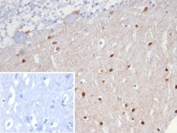 IHC staining of FFPE human brain tissue with SCGN antibody (clone SCGN/7326). Inset: PBS used in pla