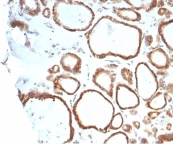 HSP90 beta Antibody / HSP90AB1