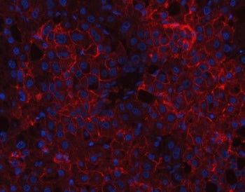 CD166 Antibody