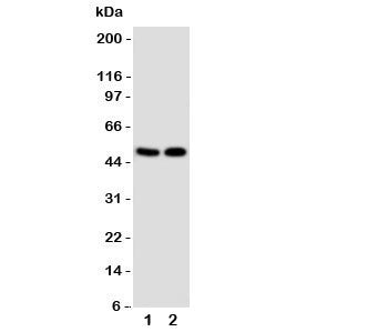 VDR Antibody (Vitamin D Receptor)