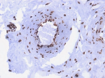 IHC staining of FFPE human colon with recombinant dsDNA antibody (clone rDSD/4565). HIER: boil tissu