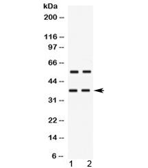 TREX2 Antibody