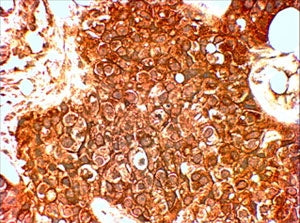 ERBB2 Antibody