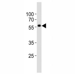 Western blot analysis of lysate from NCCIT cell line using KLF4 antibody at 1:1000. Predicted molecu