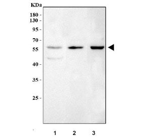 Western blot testing of 1) rat heart, 2) mouse heart and 3) mouse C2C12 cell lysate with PHD finger 