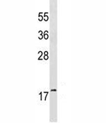 GABARAP Antibody