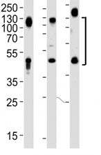 LAMP1 Antibody