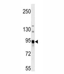 ASAH2 Antibody