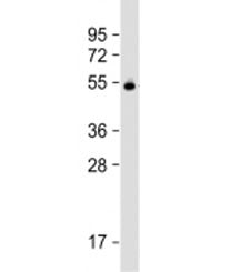 VDBP Antibody / Vitamin D binding protein