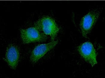 SEZ6L Antibody