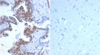 Transcriptional regulator ERG Antibody / ERG