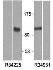 HIC1 Antibody