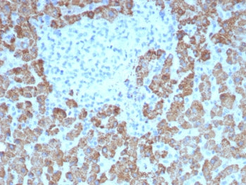 CPS1 Antibody / Carbamoyl phosphate synthetase 1