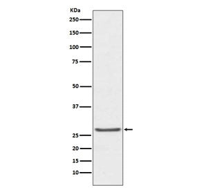 TIMP1 Antibody