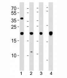 Western blot analysis of lysate from 1) U-87 MG, 2) SK-N-MC cell line, 3) human heart and 4) mouse h