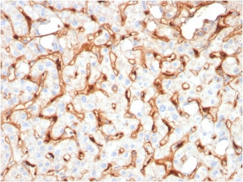 C1QB Antibody / Complement C1q B-Chain