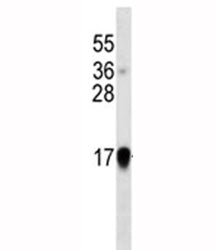 Interferon-alpha Antibody