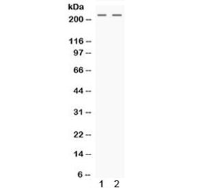 Western blot testing of human 1) HeLa and 2) HepG2 cell lysate with Nestin antibody. Predicted molec