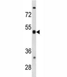 CXCR5 Antibody