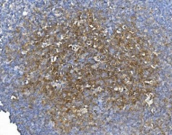 GCHFR Antibody
