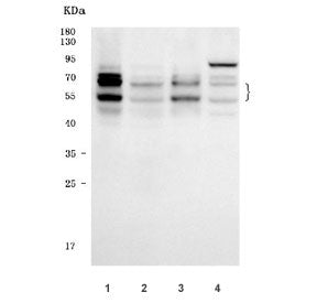 Western blot testing of human 1) Daudi, 2) Jurkat, 3) Raji and 4) K562 cell lysate with IKZF1 antibo